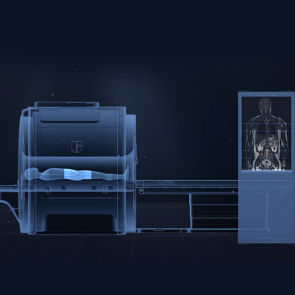 uMR 588 UNITED IMAGING 1.5 Tesla 24/48 Canales - Imagen 7