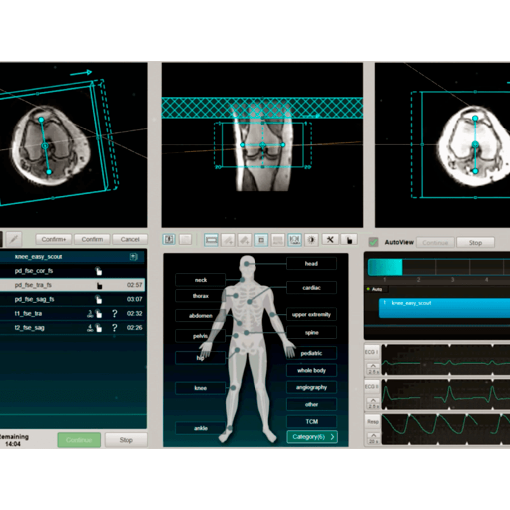 uMR 588 UNITED IMAGING 1.5 Tesla 24/48 Canales - Imagen 8