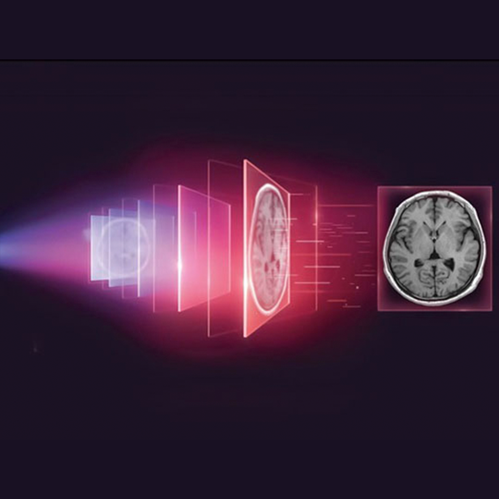 uMR 680 UNITED IMAGING 1.5 Tesla 72/96 Canales - Imagen 8